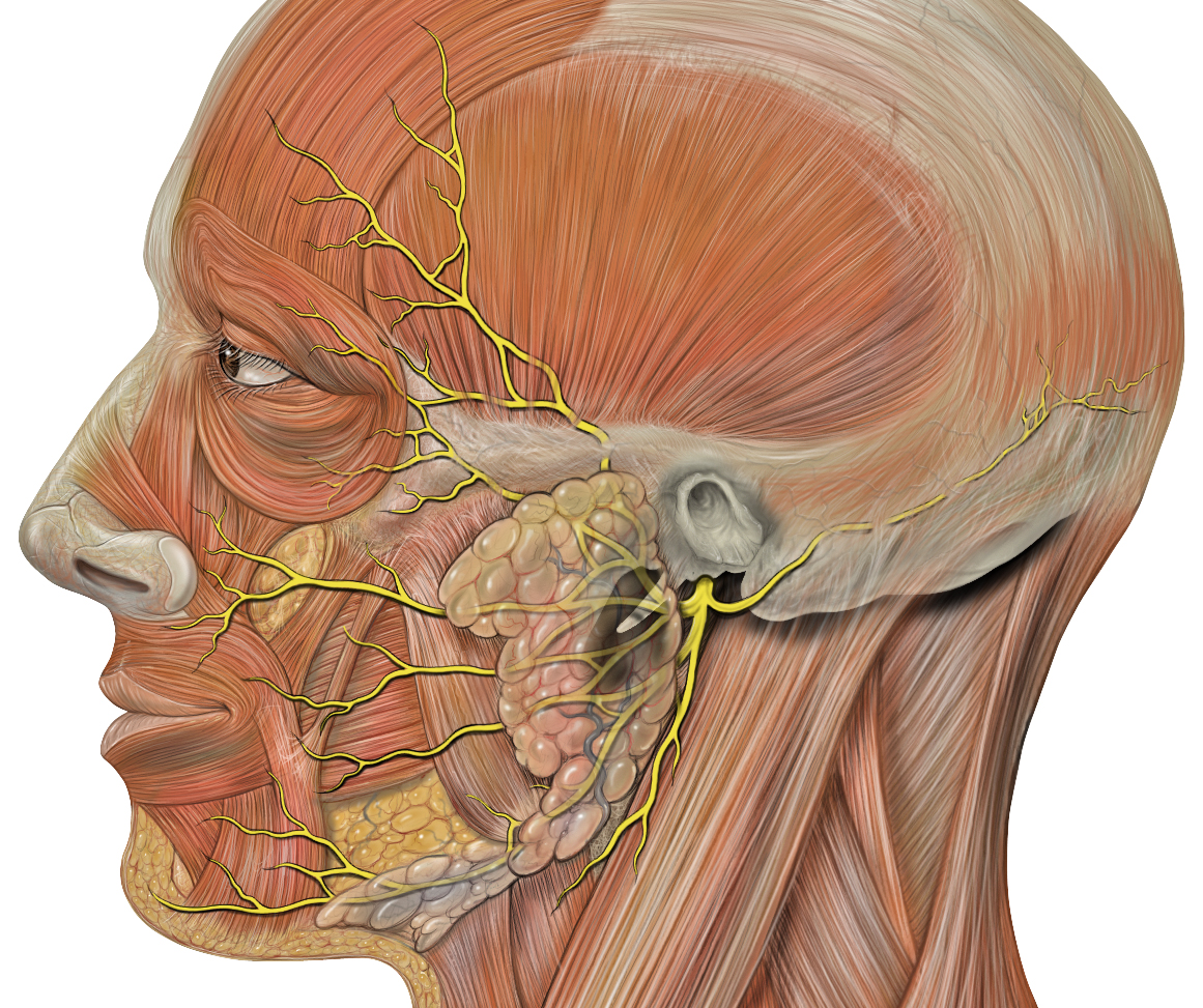 Facial Nerve Injuries/Paralysis - MPENTA